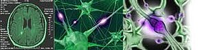 Collage bestehend aus einem MRT-Foto eines Gehirns und Bildern von Nervenfasern.